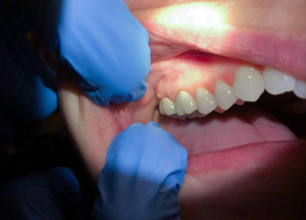 Best Emergency Treatment for Toothache in Ansonia, OH
